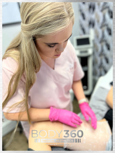 fat freezing is safe cape town 